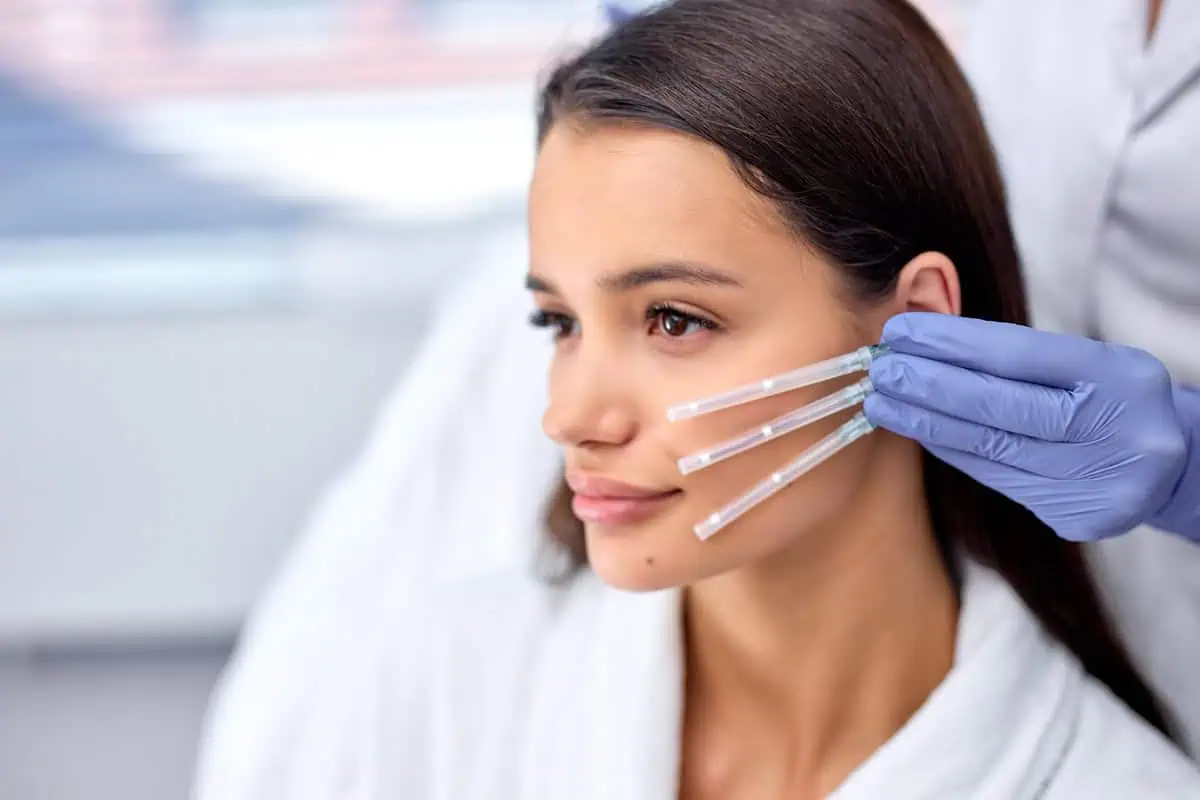 PDO Thread Lift vs. Ultherapy