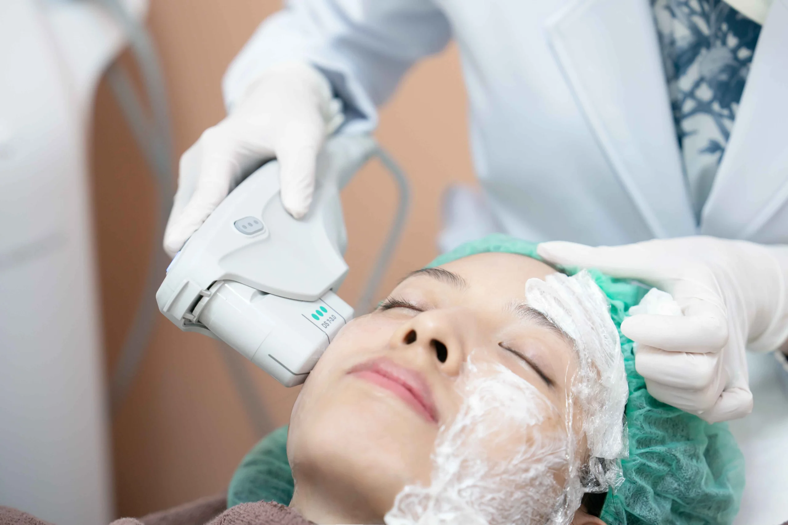 Ultherapy skin